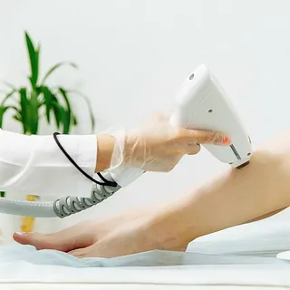 depilacion laser en piernas
